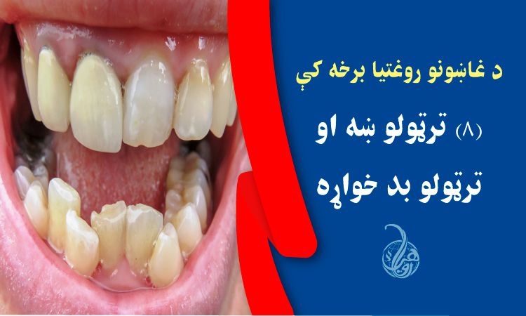 د غاښونو روغتيا برخه کې (۸) ترټولو ښه او ترټولو بد خواړه 